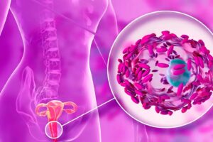 Microbioma vaginal, obesidad y reproducción