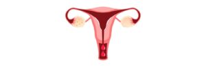 P4 y sangrado uterino anormal